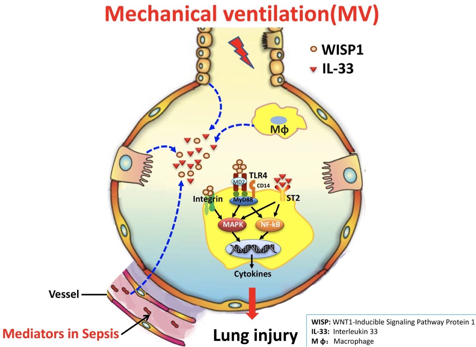 "A graphic depiction of mechanical ventilation and a lung injury"