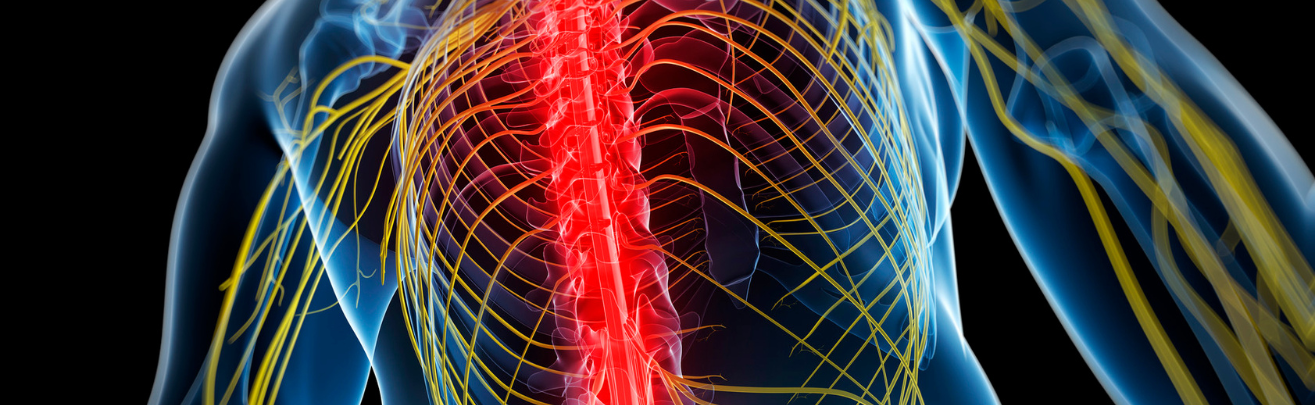 conceptual computer artwork of back pain