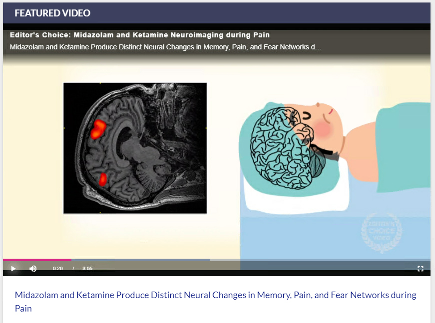 "A screenshot from the featured video, depicting midazolam and ketamine neuroimaging during pain"