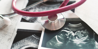A stethoscope with a pink tube rests on top of several ultrasound images, one of which clearly shows a fetal profile. The scene suggests prenatal care and medical attention during pregnancy, possibly in the context of monitoring maternal or fetal health.