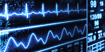 cardiac monitor