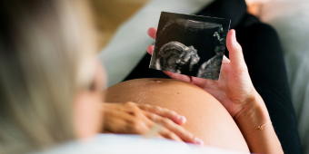 pregnant woman looking at an ultrascan photo of her baby