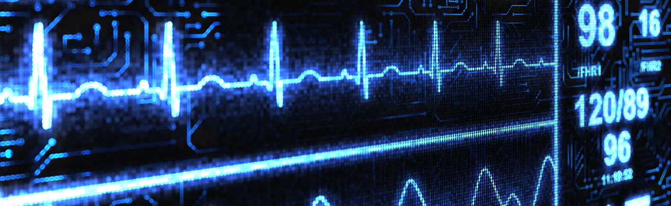 cardiac monitor